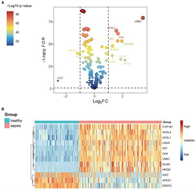 VNN1 as a potential biomarker for sepsis diagnosis and its implications in immune infiltration and tumor prognosis